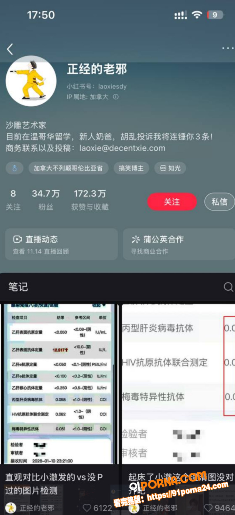 抖音300万TS伪娘网红...（14）